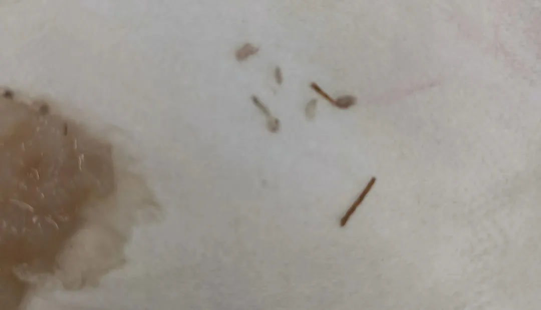 Analysis of Foreign Object Incident in Tea Drinks: What’s going on with the Taro Puree Ingredient Sweet Potato Roots?