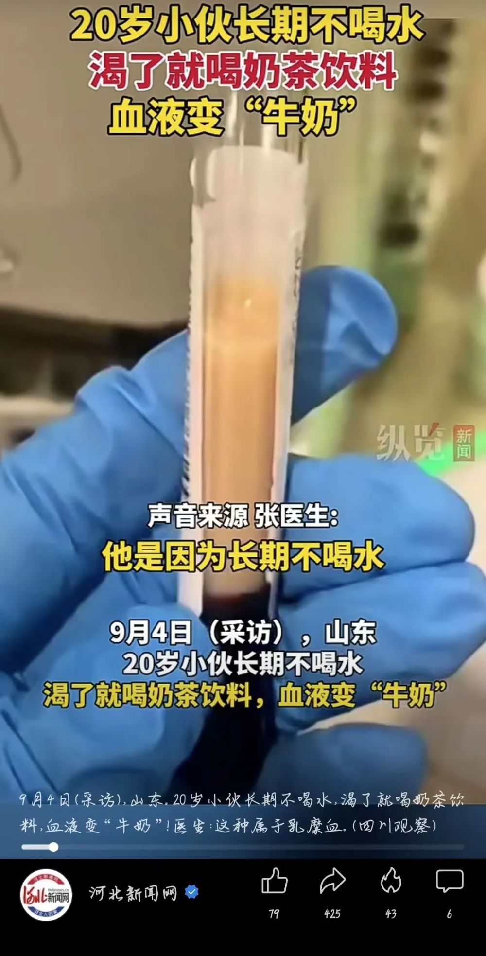 20-year-old man's blood turns milky white – drinking bubble tea as water may lead to risk of chylomicronemia